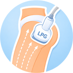 lpg массаж в Клину в Надежде